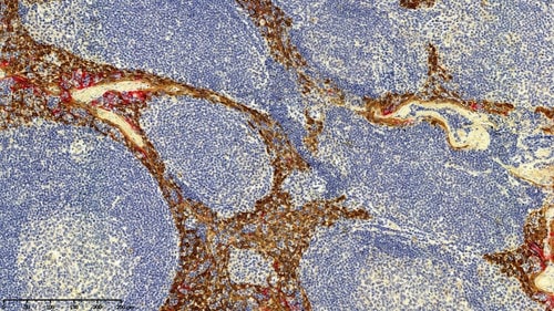 Close-up view of 3D human tonsil tissue colored with IHC staining colors.