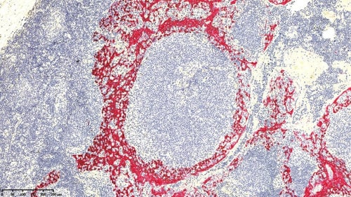 Close-up view of Cytokeratin 5 (CK5) protein cell.