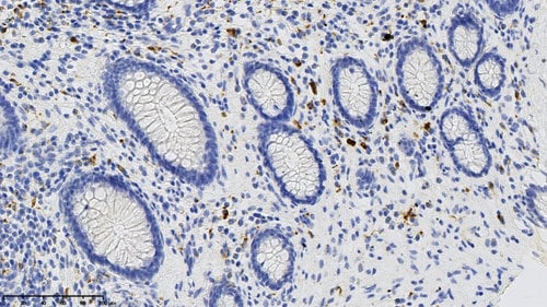 3D view of a IHC staining of CD68 protein.
