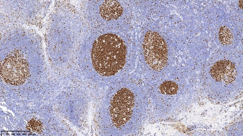 Close-up view of Ki67 protein found in B cell.
