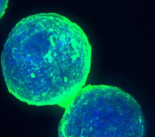 3D view of human liver cell spheroids.