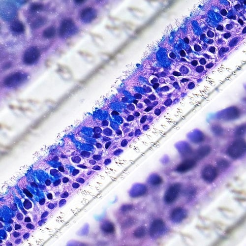 Close-up view of 3D nasal cell colored with hematoxylin and eosin.