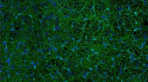 3D view of Neuronal cells from a human induced pluripotent stem cells.