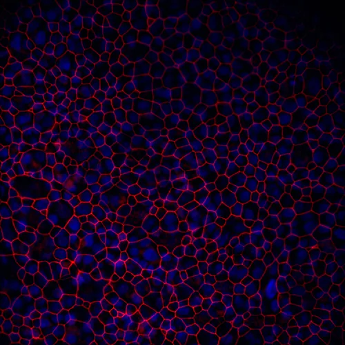 3D human organotypic bronchial cell.
