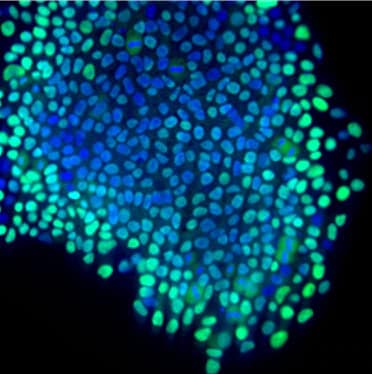 Blue and green human induced pluripotent stem cells, cultivated for Parkinson's disease neuronal model.