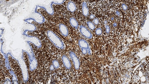Close-up view of human appendix tissue showing protein vimetin.