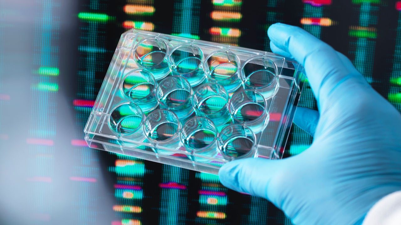 Scientist in blue gloves holding a sample plate