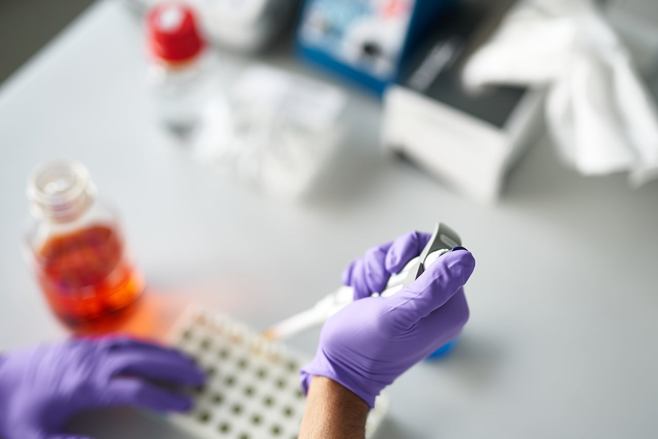 Hands in gloves holding a pipette