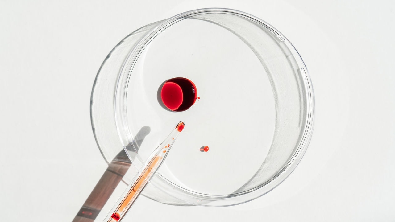 Pipette dropping blood on petri dish