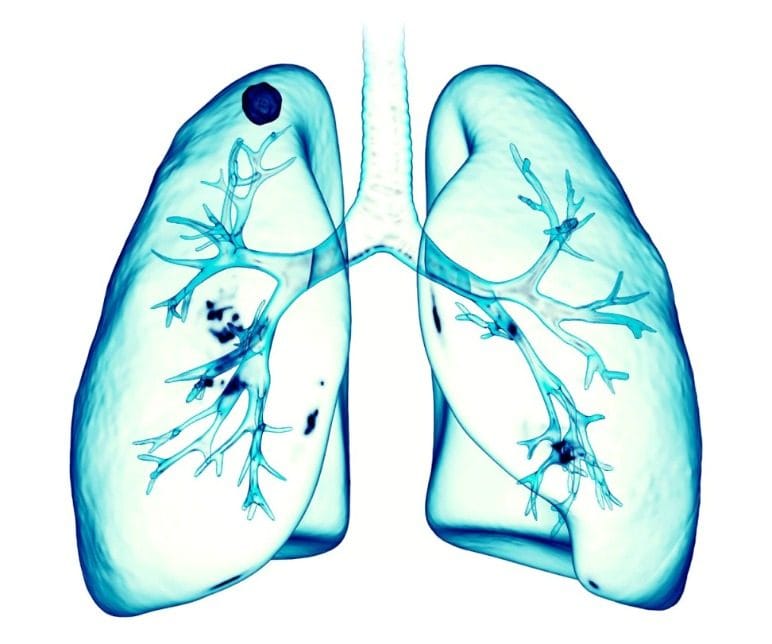 The respiratory system's lungs.